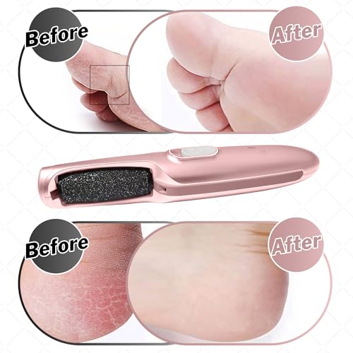 Powerful Electric Callus Remover Wand – Rechargeable Foot File, Grinder Removes Dead, Hard Skin & Calluses for Men & Women – Best Pedicure Tool for Soft, Smooth Feet